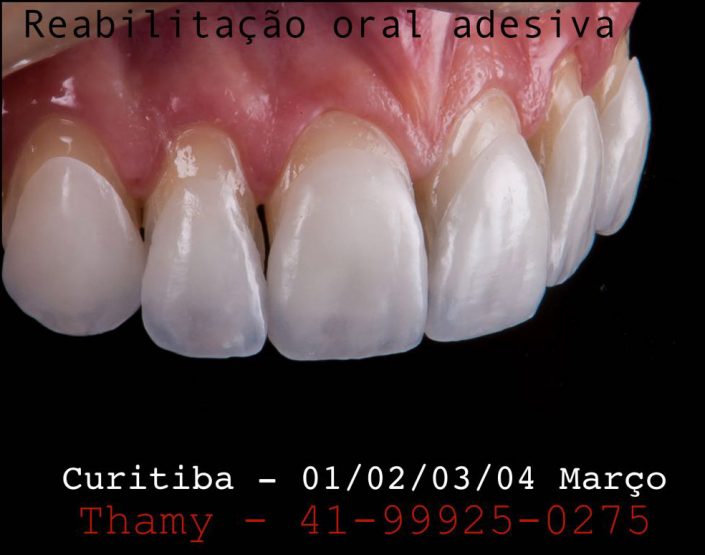 Cursos Odontológicos em Curitiba | Dr Albano Luis Bueno